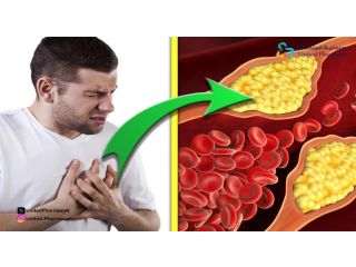 اعراض دواء الكولسترول