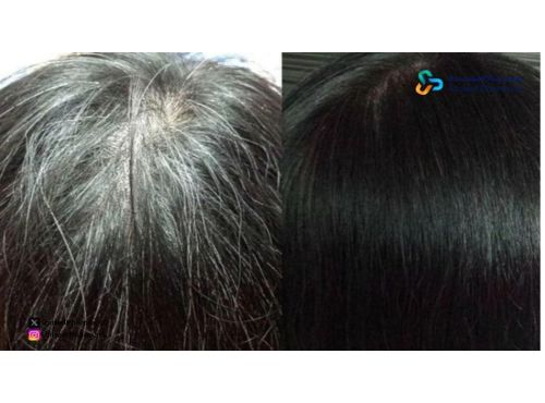 أفضل صبغة للشيب من الصيدلية