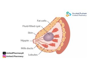 الكيس الدهني في الثدي